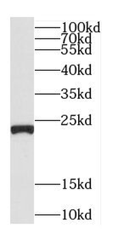 C5orf24 Rabbit Polyclonal Antibody