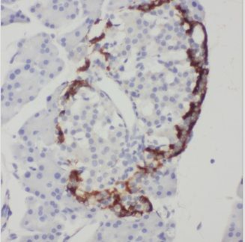 C5orf24 Rabbit Polyclonal Antibody