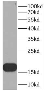 OARD1 Rabbit Polyclonal Antibody
