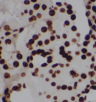 OARD1 Rabbit Polyclonal Antibody