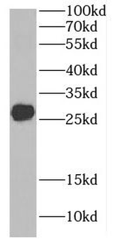 C9orf72 Antibody