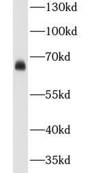 CA9 Rabbit Polyclonal Antibody