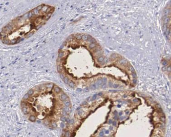CA9 Rabbit Polyclonal Antibody