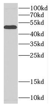 CA9 Rabbit Polyclonal Antibody