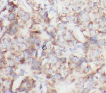 CA1 Rabbit Polyclonal Antibody