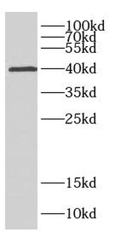 CA10 Rabbit Polyclonal Antibody