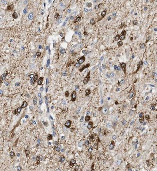 CA10 Rabbit Polyclonal Antibody