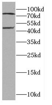 CA12 Rabbit Polyclonal Antibody