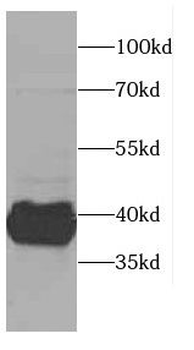 CAB39L Rabbit Polyclonal Antibody