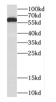 COQ8A Rabbit Polyclonal Antibody
