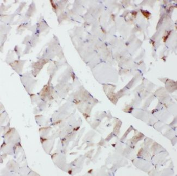 CACNA1S Rabbit Polyclonal Antibody