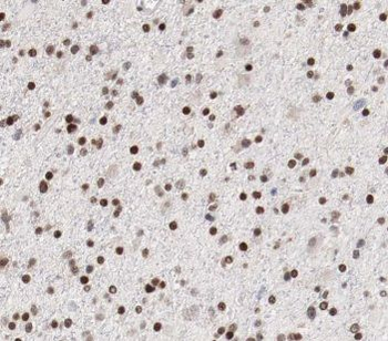 CACYBP Antibody