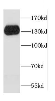 CDH16 Rabbit Polyclonal Antibody
