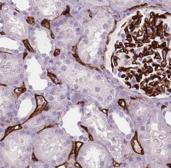 CDH16 Rabbit Polyclonal Antibody