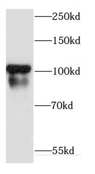 CDH18 Rabbit Polyclonal Antibody