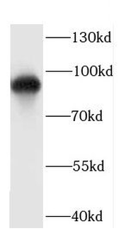 CDH7 Rabbit Polyclonal Antibody