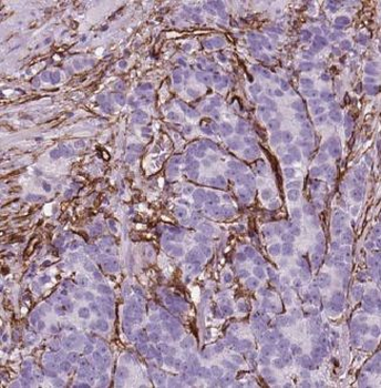 CDH7 Rabbit Polyclonal Antibody