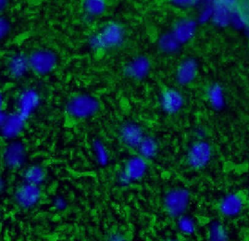 CALB1 Antibody