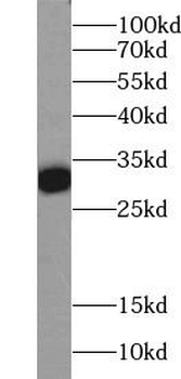 CALB1 Antibody