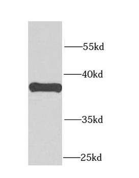 CALHM1 Rabbit Polyclonal Antibody