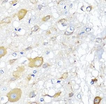 CALHM1 Rabbit Polyclonal Antibody