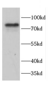 CAPN1 Rabbit Polyclonal Antibody