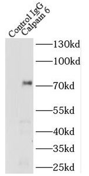 CAPN6 Rabbit Polyclonal Antibody