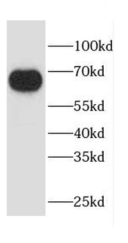 CAPN6 Rabbit Polyclonal Antibody