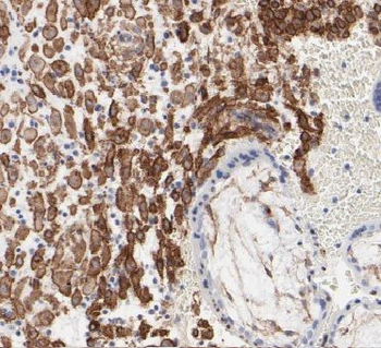 CAPN6 Rabbit Polyclonal Antibody