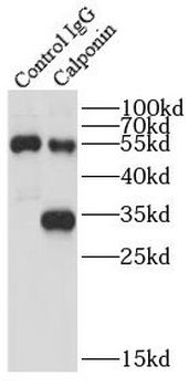 CNN1 Antibody
