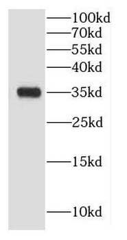 CNN1 Antibody