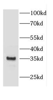 CNN1 Antibody