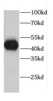 CALR3 Rabbit Polyclonal Antibody
