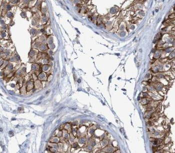 CALR3 Rabbit Polyclonal Antibody