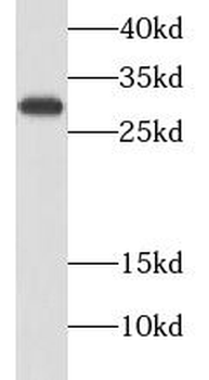 CALB2 Antibody