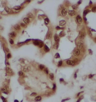 CALB2 Antibody