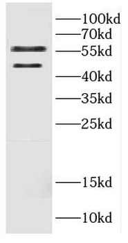 CALU Rabbit Polyclonal Antibody
