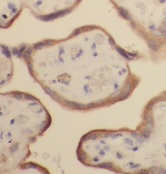 CALU Rabbit Polyclonal Antibody