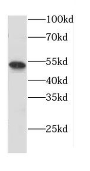 CNR1 Rabbit Polyclonal Antibody