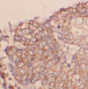 CNR1 Rabbit Polyclonal Antibody
