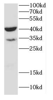 CANT1 Rabbit Polyclonal Antibody