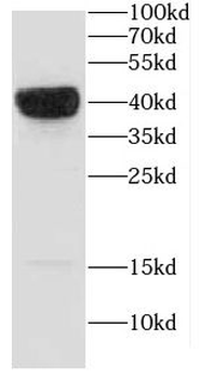 CAPG Rabbit Polyclonal Antibody