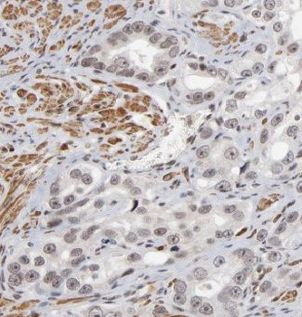 CAPG Rabbit Polyclonal Antibody