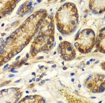 CAPNS1 Rabbit Polyclonal Antibody