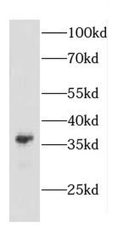 CAPZA2 Antibody
