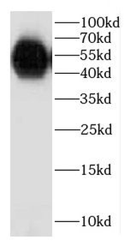CPA2 Rabbit Polyclonal Antibody