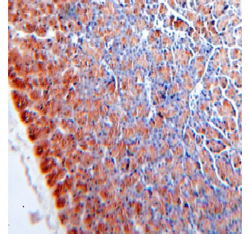 CPA2 Rabbit Polyclonal Antibody
