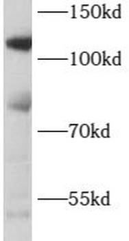 CARD14 Antibody