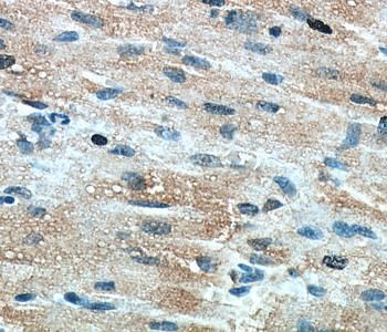 TNNT2 Rabbit Polyclonal Antibody