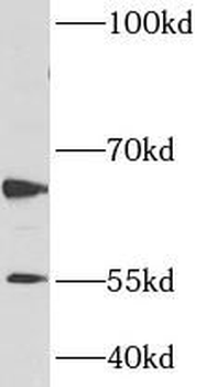 CARM1 Rabbit Polyclonal Antibody